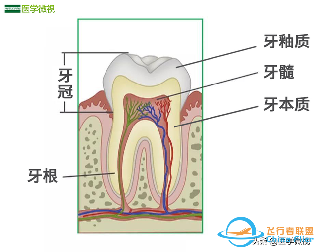 吃止痛药都没用的牙髓炎，只有这样做才能不疼-2.jpg